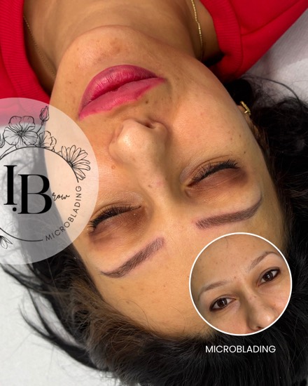 Résultat microblading : correction et repigmentation des sourcils, forme redessinée, avant en médaillon.